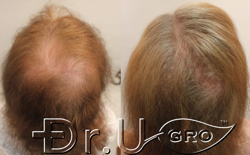 Gashee Real Life Stories: Laura noticed improved fullness, length, texture, sheen and shine and overall hair health