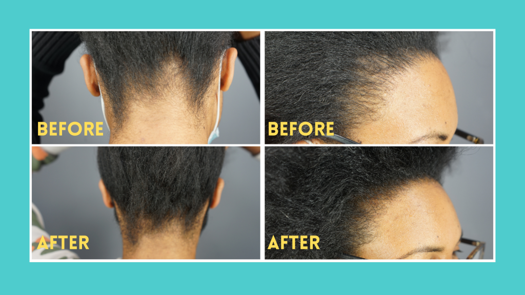 Keratin for hair before and after results - Dr.UGro Gashee Hair Growth Products Infused with Keratin