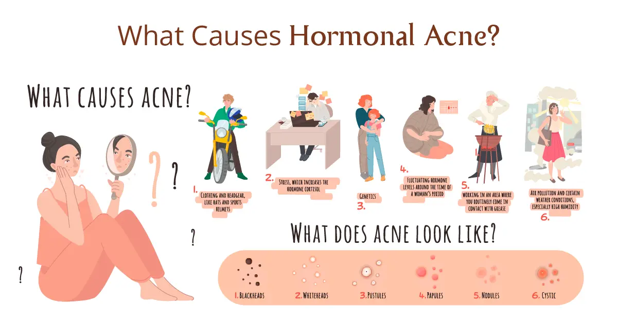 What Causes Hormonal Acne?