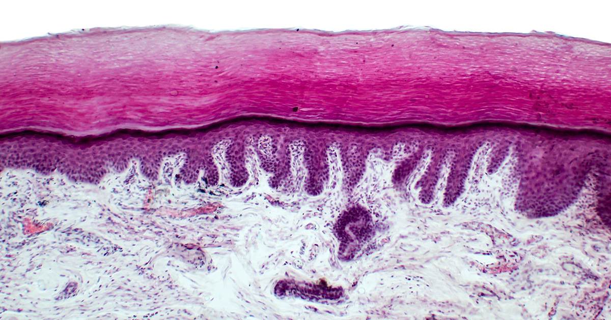 How The Skin Barrier Works