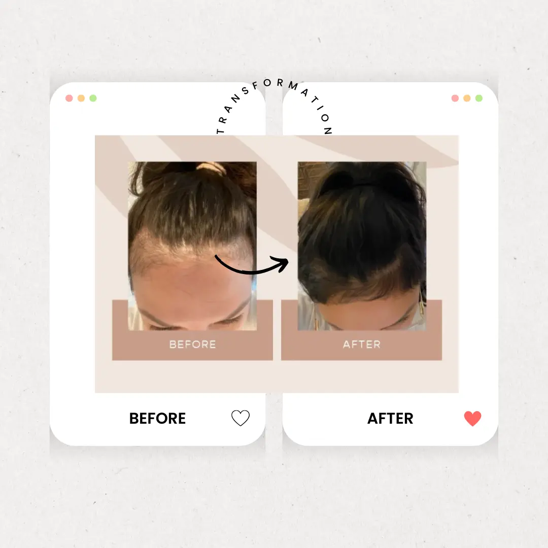 Is Rice Water Good for Hair?