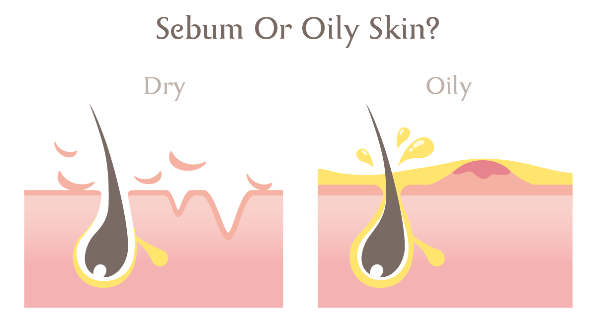 How Does Pregnancy Affect Sebum Production?