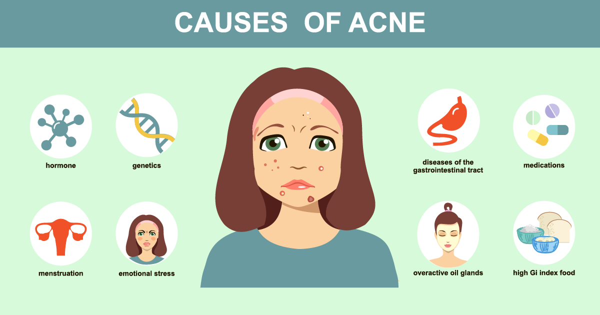 acne during pregnancy