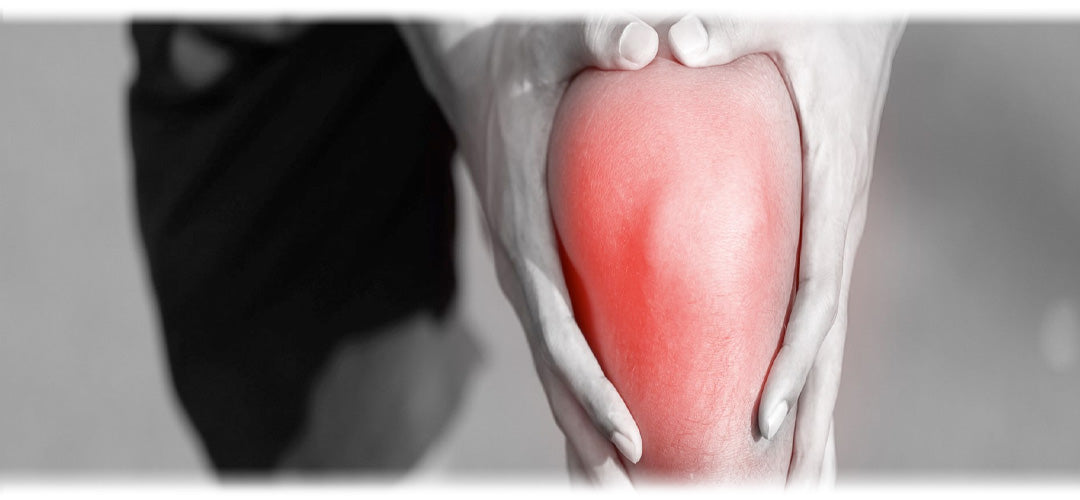 An inflamed knee joint