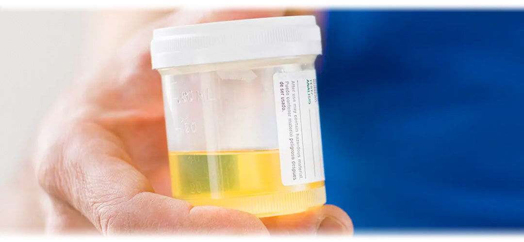 Urine Sample